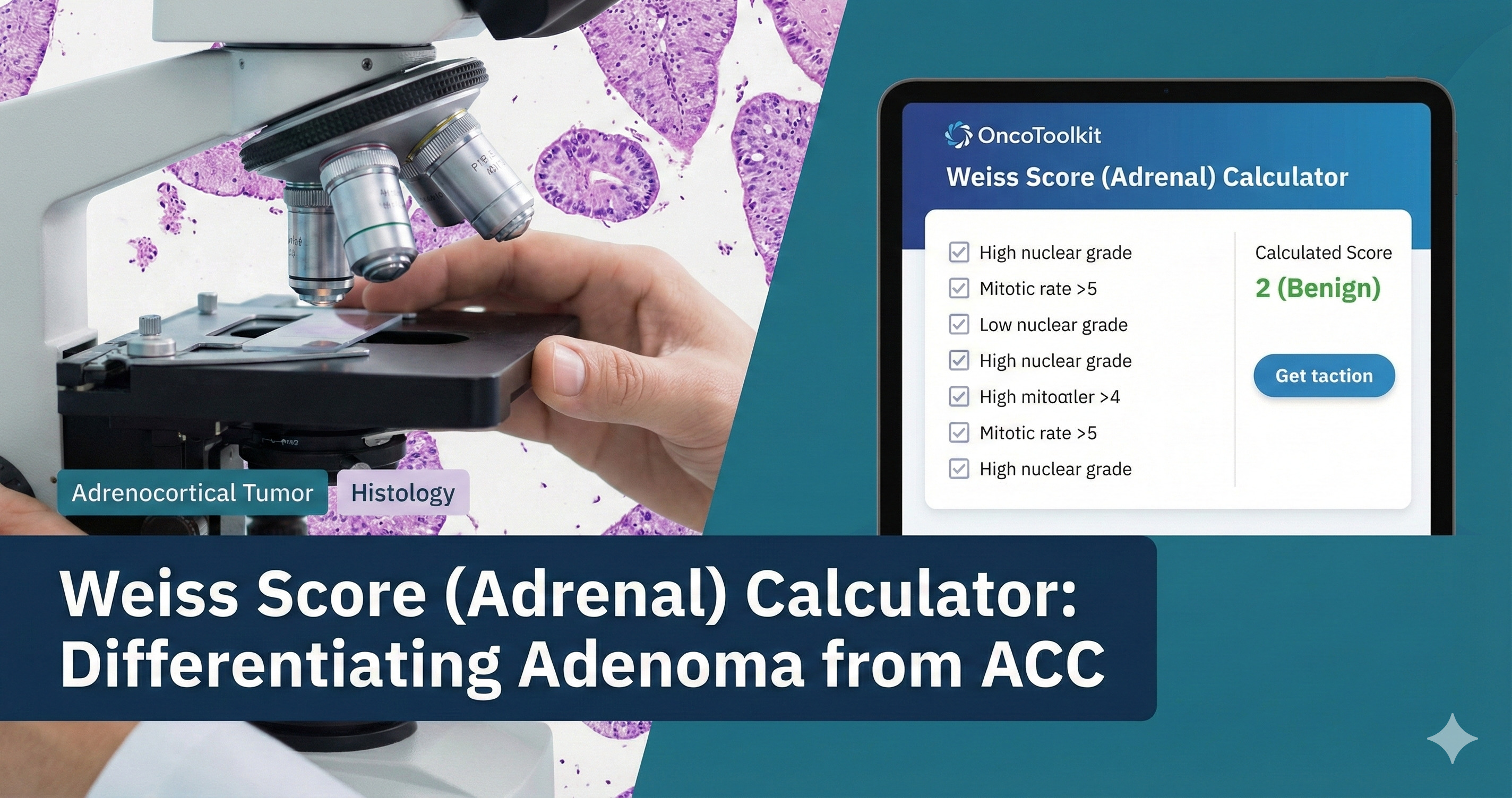 Weiss Score (Adrenal) Calculator: Differentiating Adenoma from ACC